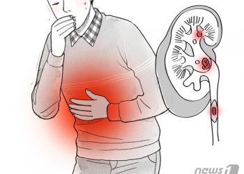 증상없는 ‘신장암’…복부초음파 검사로 80% 잡아낸다