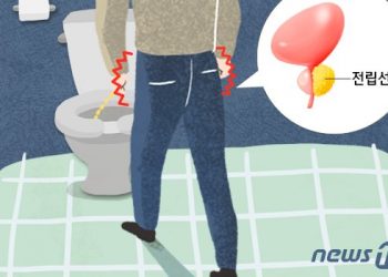 뚱보 노리는 ‘아버지 암’ 전립선암…로봇수술로 효과
