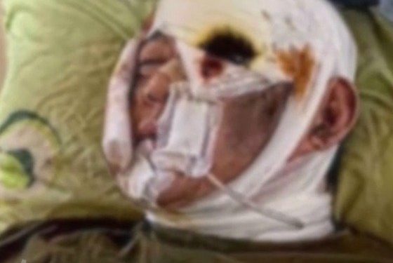 북한군 유일 생존자?…”전우 시체 밑에 숨어서 살았다” 영상 등장