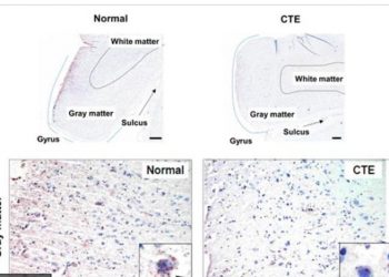 뇌 손상 회복하는 단백질 결합 발견…”난치성 뇌질환 치료 기대”
