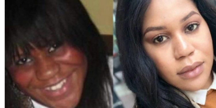 10년 넘게 크림 발랐더니 얼굴색 하얗게 된 흑인여성