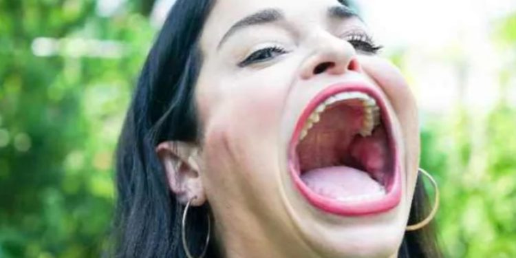 “사과 1개를 한입에”…’세계에서 가장 큰 입’ 기네스북女