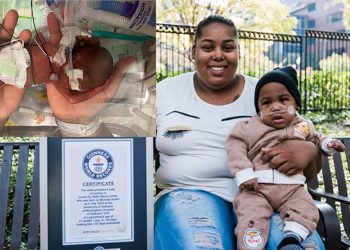 임신 21주 하루만에 태어난 앨라배마 아기 생존…세계 기록