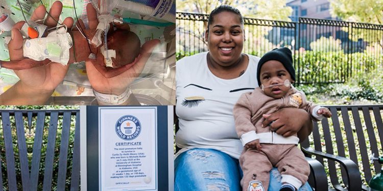 임신 21주 하루만에 태어난 앨라배마 아기 생존…세계 기록