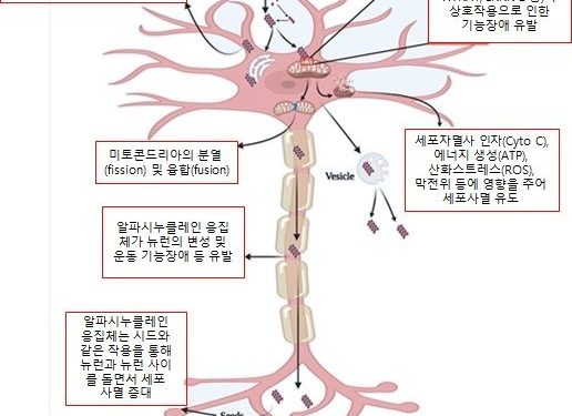 파킨슨병 발병 연결고리 규명…퇴행성 뇌질환 극복 청신호