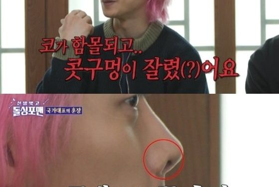 곽윤기 “코 함몰에 콧구멍까지 잘려”…쇼트트랙 부상 고백