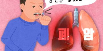 비흡연 여성 폐암이 늘고 있다…간접 흡연 만큼 위험한 ‘이것’