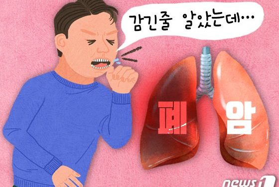 비흡연 여성 폐암이 늘고 있다…간접 흡연 만큼 위험한 ‘이것’