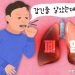 비흡연 여성 폐암이 늘고 있다…간접 흡연 만큼 위험한 ‘이것’