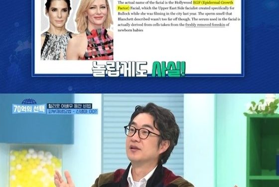 “포경수술서 떼낸 표피로 여배우들 피부 관리”…美 특급 시술 화제