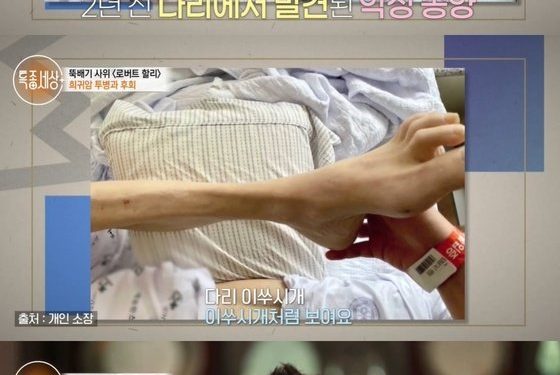 ‘마약 투약’ 로버트 할리, 희귀암 투병 “다리가 이쑤시개처럼 돼”