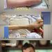 ‘마약 투약’ 로버트 할리, 희귀암 투병 “다리가 이쑤시개처럼 돼”