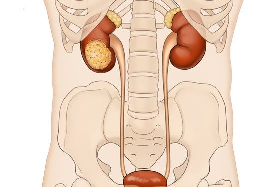 18일 ‘신장암의 날’…증상없이 찾아와, 검진 통해 ‘조기 진단’ 필요