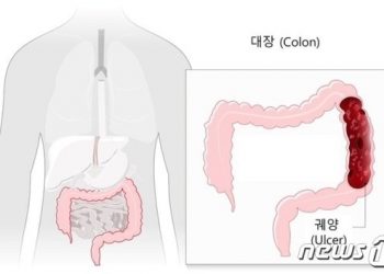 ‘4주 넘게 설사’ 계속되고 혈변…’궤양성 대장염’ 가능성