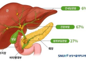 민물고기 회 먹고 황달 걸렸다면…’담관암’ 의심