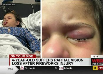 4살 소녀, 불꽃놀이 부상으로 시력 잃어