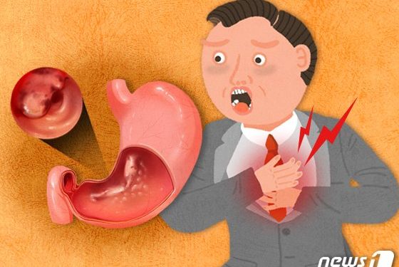 ‘소리 없는’ 위암, 작년 16만명…”술·담배 많은 남성, 여성의 두배”