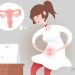 생활습관 변화 탓에 ‘부인암’ 발생 연령대 점차 낮아진다