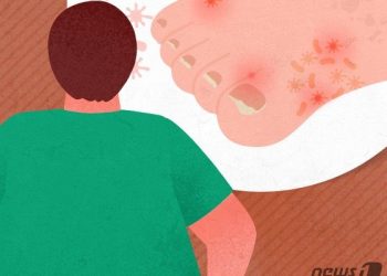 무좀약은 독하다고? 옛날 얘기…”안전한 약으로 처방 중”