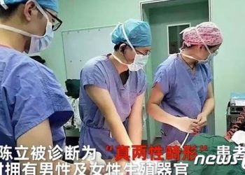 30대男 20년간 겪은 혈뇨, 생리였다…33년 만에 女생식기 발견