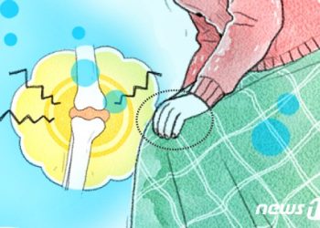 뚝 떨어진 기온, 관절 더 뻣뻣해졌다면 ‘류머티즘 관절염’ 의심