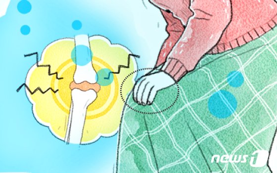 뚝 떨어진 기온, 관절 더 뻣뻣해졌다면 ‘류머티즘 관절염’ 의심