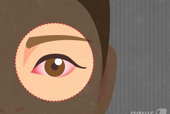 소리 없는 시력 도둑 ‘녹내장’…안개 낀듯 침침한 증상