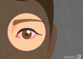 젊은층도 백내장 조심…”당뇨병·자외선 노출·흡연 등 연관”