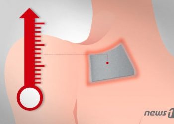 핫팩 붙인 곳 조금씩 가렵더니…저온화상의 기습