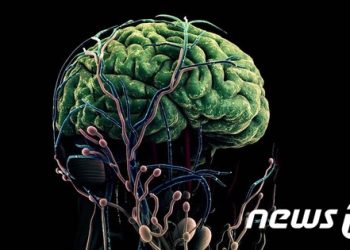 “알츠하이머 임상에 다운증후군 환자도 넣자…치료제 단서 기대”