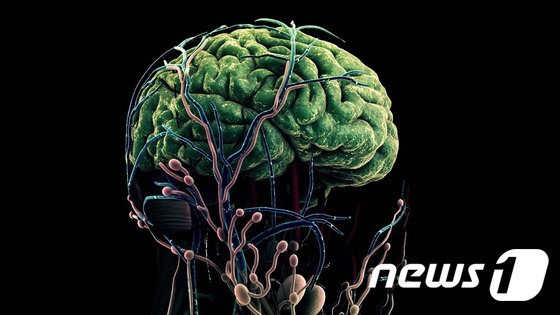 “알츠하이머 임상에 다운증후군 환자도 넣자…치료제 단서 기대”