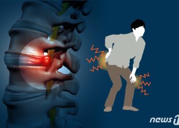 아침부터 허리 ‘뻣뻣’ 통증…젊은층 ‘강직척추염’ 주의보