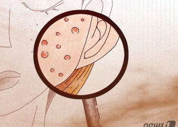 여드름약 먹는다면 임신·헌혈 금물…기형아 출산 우려