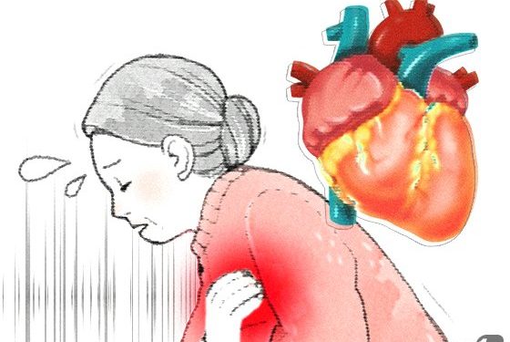 심근경색 환자, 어떤 약 먹느냐에 따라 뇌졸중·심부전 위험 달라져