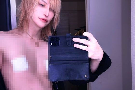 “연주에 방해” 젖꼭지 제거한 기타리스트 ‘경악’…손엔 마이크로칩 삽입