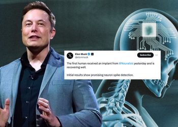 머스크 “뇌에 인공칩 심은 첫 인류 탄생”…생각으로 컴퓨터 조작 목표