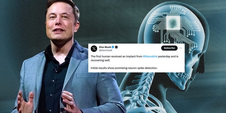 머스크 “뇌에 인공칩 심은 첫 인류 탄생”…생각으로 컴퓨터 조작 목표