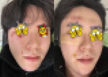 “길 안 비켰다고 30명이 집단 폭행”…귀가하던 가족 악몽의 ‘설 명절’