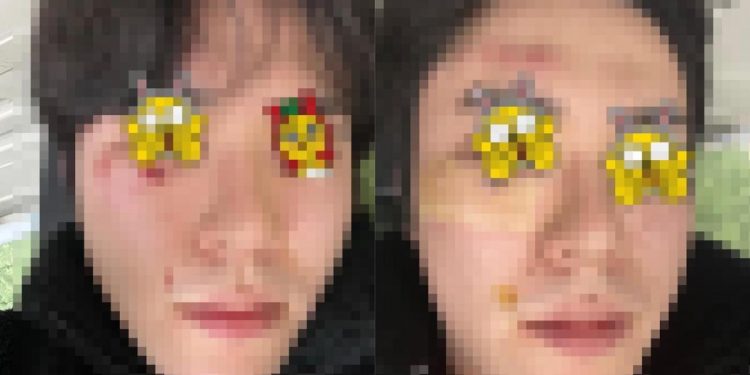 “길 안 비켰다고 30명이 집단 폭행”…귀가하던 가족 악몽의 ‘설 명절’