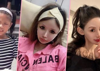 7.4억 들여 100번 성형한 10대 소녀…”생각할 수 있는 모든 수술 다 받았다”