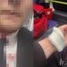 “피시방서 목에 칼침 맞았다”…앞자리 ‘조용히’ 요청에 흉기 휘두른 40대