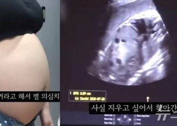 “우리 애는 36주에 태어났는데, 거긴 그냥 살인이네”…낙태 유튜버에 분노