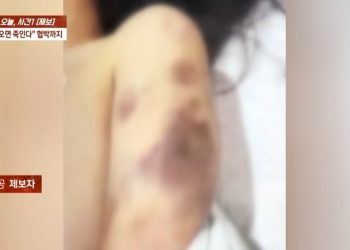 재수생 여친 모텔로 불러 옷 벗기고 3시간 폭행, 간 파열 ‘충격’