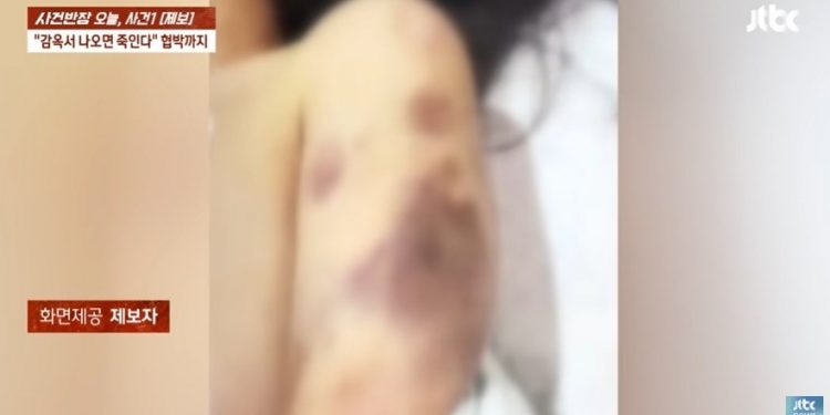 재수생 여친 모텔로 불러 옷 벗기고 3시간 폭행, 간 파열 ‘충격’