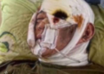 북한군 유일 생존자?…”전우 시체 밑에 숨어서 살았다” 영상 등장