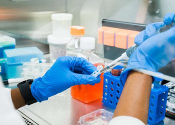 UAB, 인간 뇌 조직을 우주로…알츠하이머 연구 대담한 도전