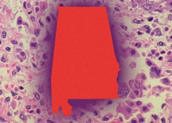 앨라배마 보건당국 “홍역 발생 가능성 대비”…“확진 사례 곧 나올 것”