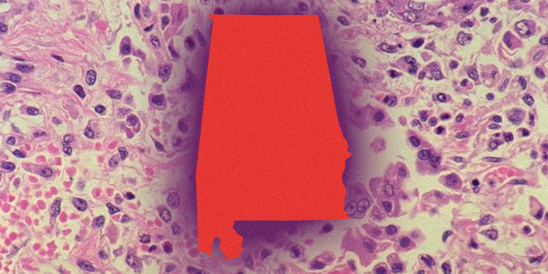 앨라배마 보건당국 “홍역 발생 가능성 대비”…“확진 사례 곧 나올 것”