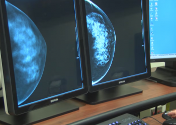 “유방암 검사 무료화?”…앨라배마 새 법안 서명 대기