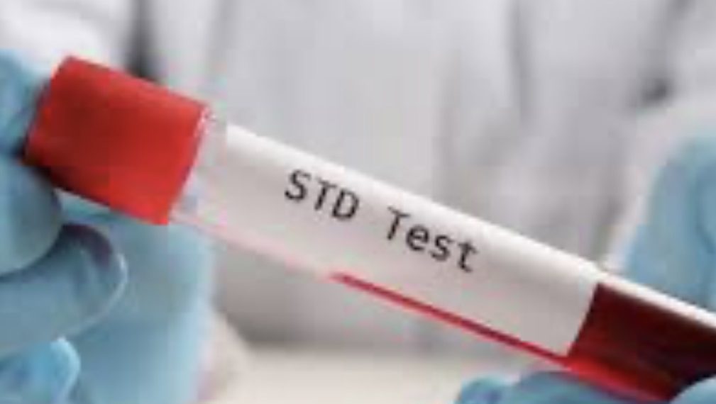 “치료 못해 더 퍼진다”…앨라배마 매독 급증, 최악 상황 오나